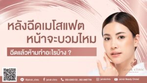 ฉีดเมโสแฟต หน้าจะบวมไหม