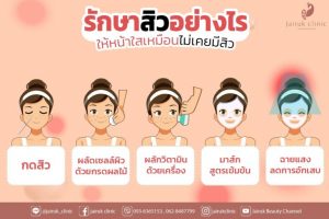 Read more about the article รักษาสิว อย่างไรให้หน้าใสเหมือนไม่เคยมีสิว รีวิวโปรแกรมรักษาสิวตั้งแต่ต้นจนจบ by Jairuk clinic