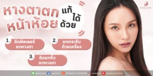 Read more about the article หางตาตก หน้าห้อย ดูไม่สดใส ทำยังไงได้บ้าง