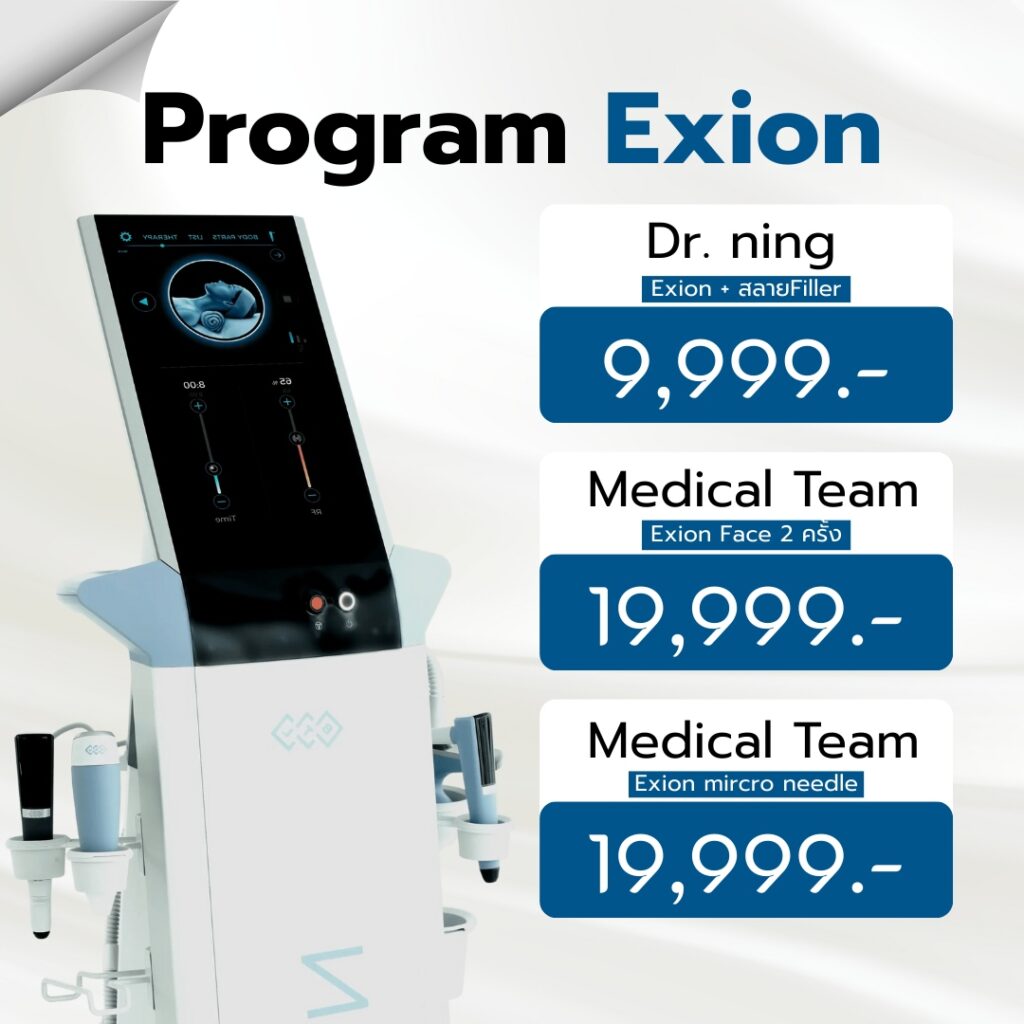 Exion